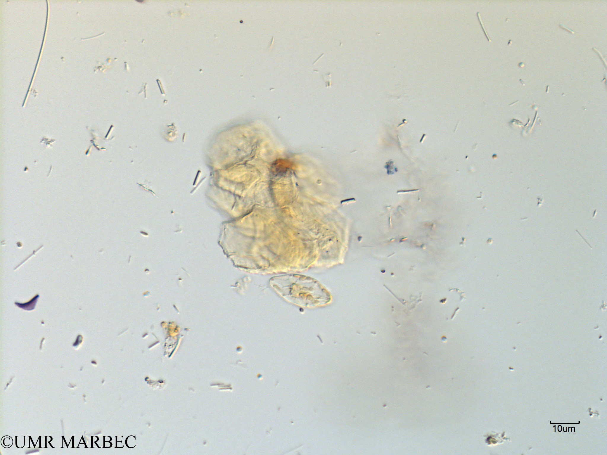 phyto/Scattered_Islands/mayotte_lagoon/SIREME May 2016/Gomphonema sp1 (MAY10_pennee laquelle c-1).tif(copy).jpg